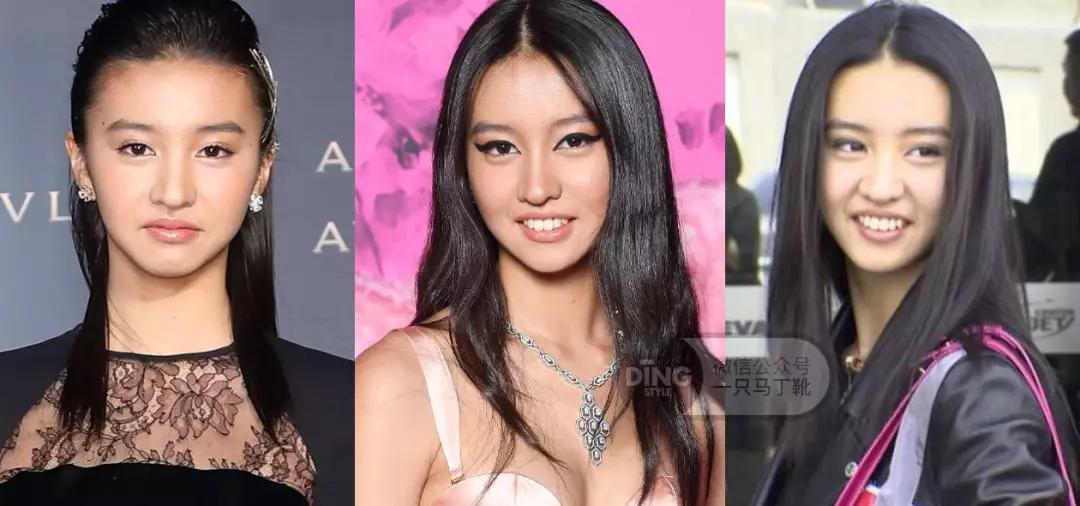 戴牙套凸嘴怎么化妆,凸嘴整牙削骨吗