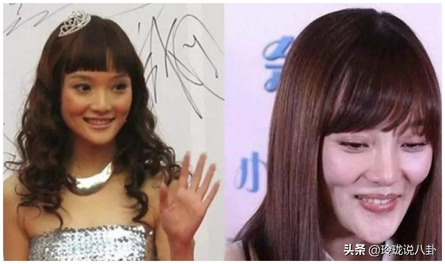 有哪些明星过度整容惨不忍睹,整容失败女明星今昔对比