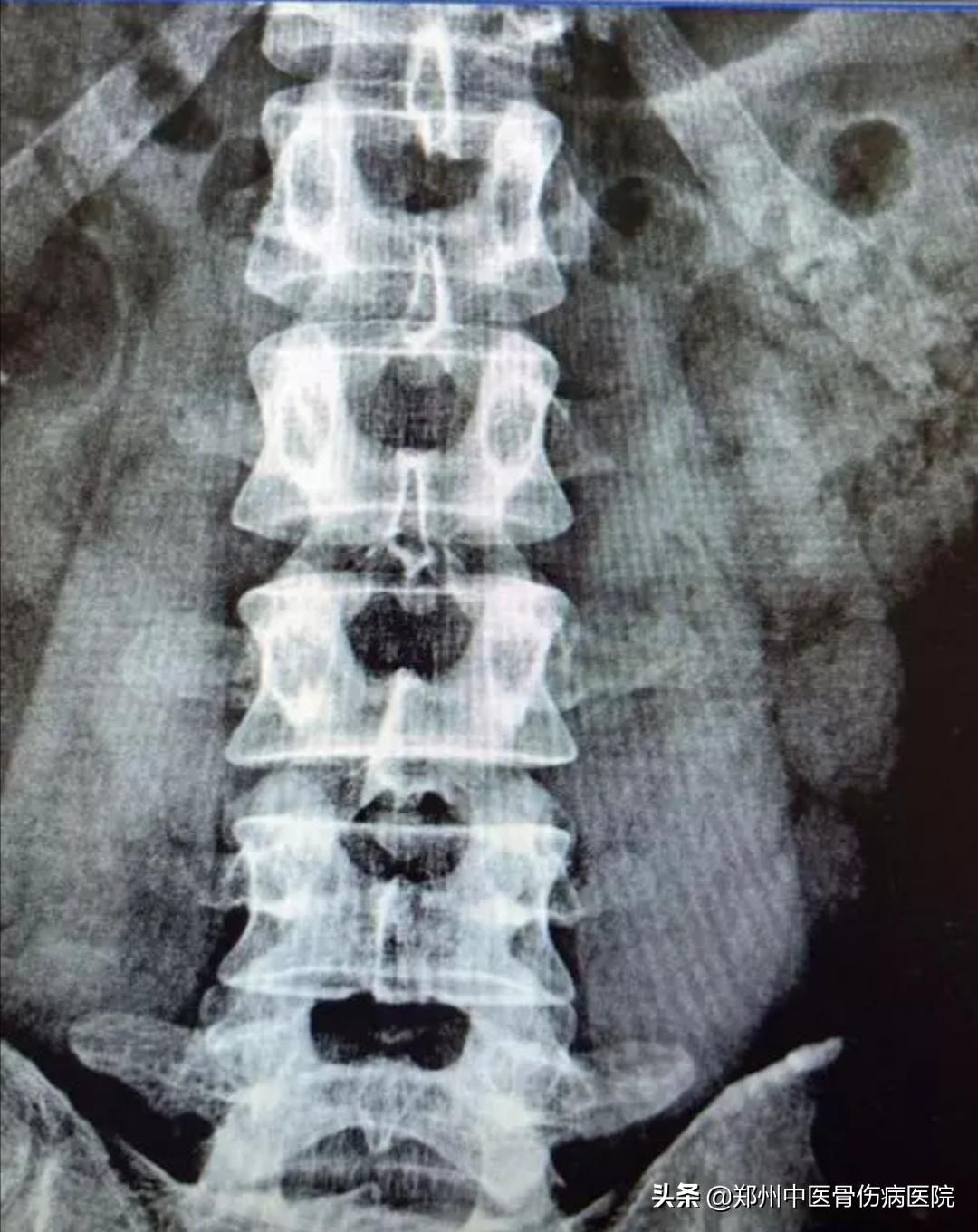 被青春撞了一下腰原版视频,我被青春撞了一下腰原版