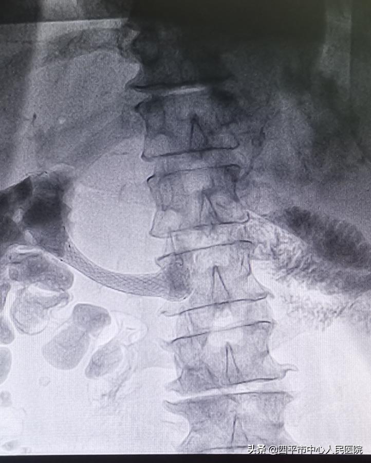 多学科联合手术救治患者,多学科联合抢救病人