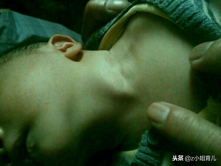 别再这样抱宝宝了，会歪脖子你还不知道吧，分享下如何纠正歪脖子
