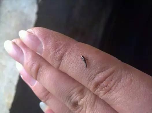 隐翅虫咬人后早期图片及症状,隐翅虫咬人后图片和症状