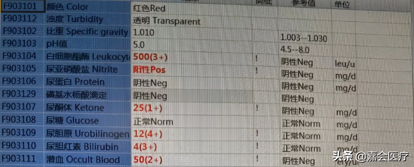 尿液变绿,吃了药尿液变绿是怎么回事