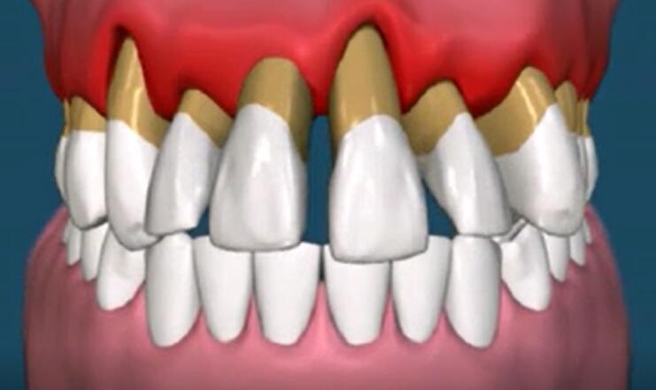 狗狗洗牙的良心忠告,医生忠告千万别洗牙