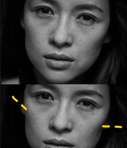 颧骨高太阳穴凹陷怎么改变面相,人中长颧骨高适合什么发型