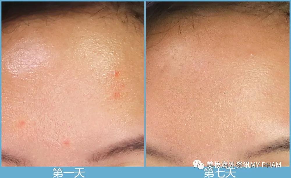 露得清哪个牌子适合混合肌肤,露得清抗老紧致