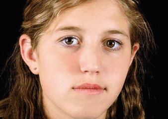 祛脸上斑点色斑的小妙招,一个动作教你如何淡化色斑