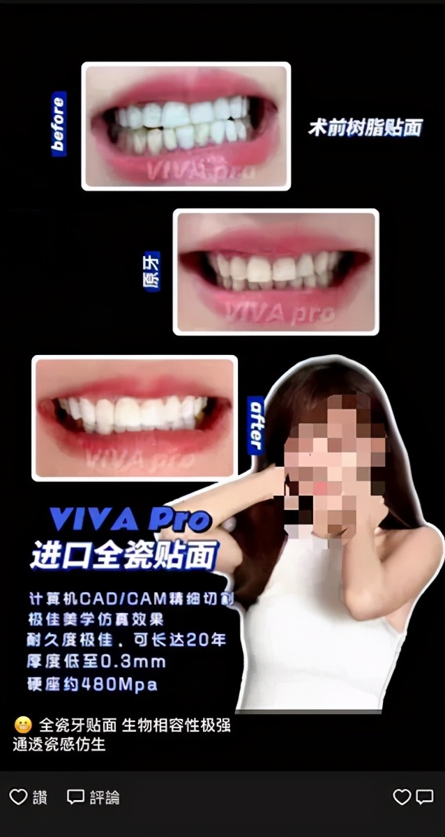 火出圈的“明星同款”,细节触目惊心!专家:问题多风险大