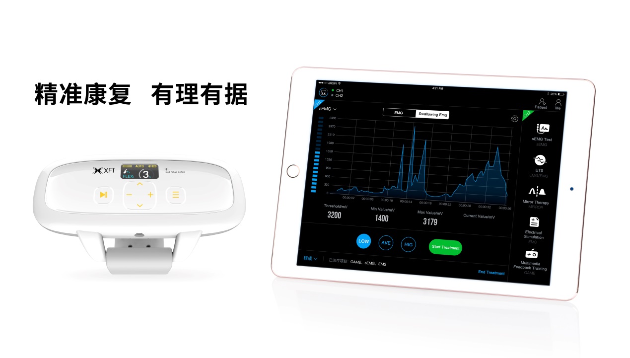 生物反馈电刺激治疗费用,生物反馈电刺激治疗操作流程
