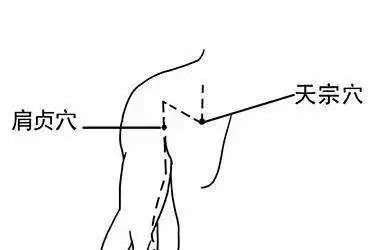 颈肩病最好的治疗方法,肩颈病治疗方法