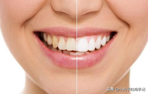 李沁牙膏真的有效果吗,李沁的黄牙变白了