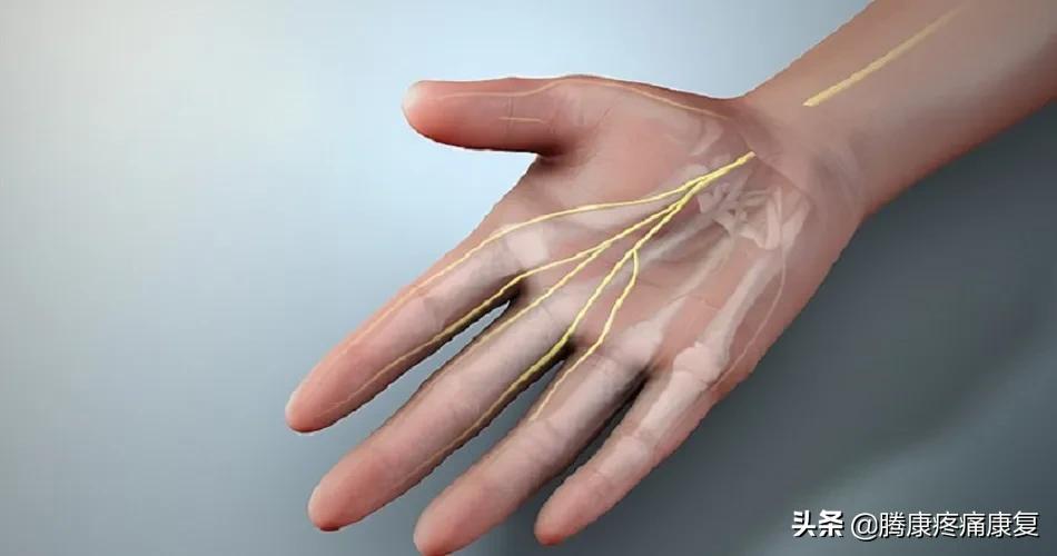 正中神经损伤治疗方法,正中神经损伤康复训练
