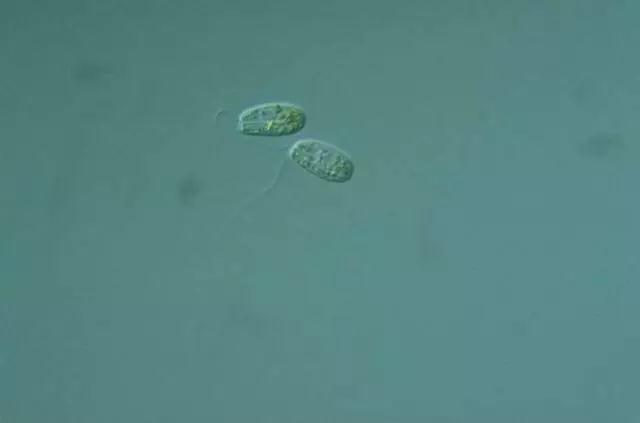 收藏!24种污水处理微生物菌相及指导意义,环保人必看(多图)