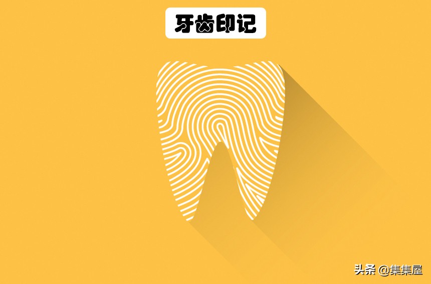 世界上最奇特的指纹,除了指纹还有什么是独一无二的