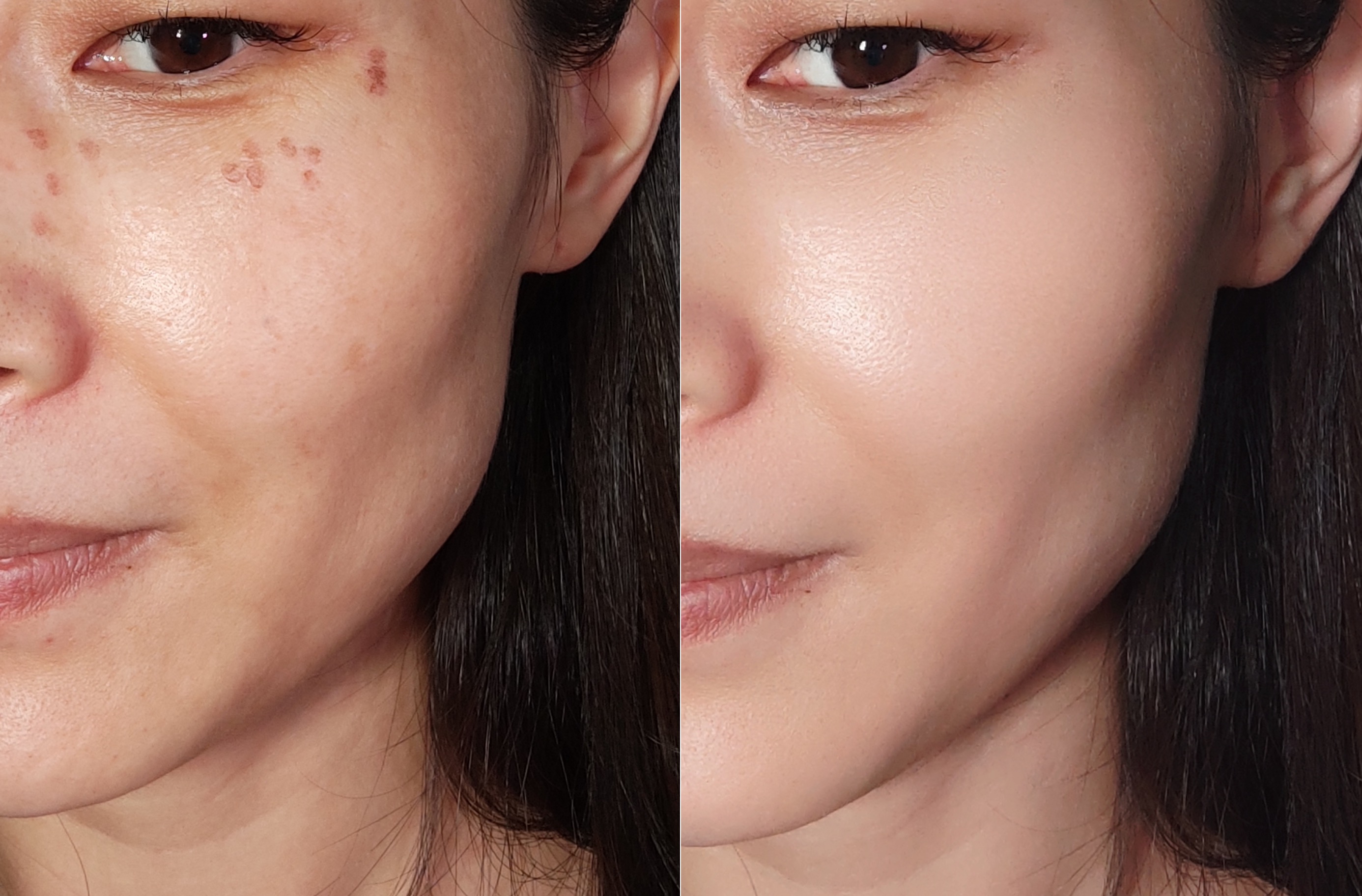 小米Civi自拍效果有多强?知名数码博主晒自拍,痘痘神奇的消失了