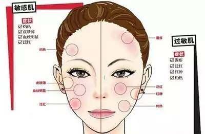 敏感肌30秒自测,敏感肌全套护肤推荐