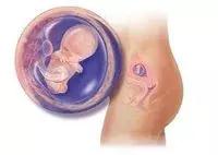 电影中大部分的流产其实都是胎膜早破的现象!