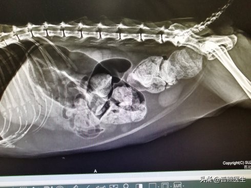 治疗便秘导致的后果,为什么便秘久治不愈