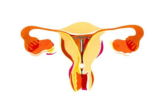 取环的注意事项有以下几点