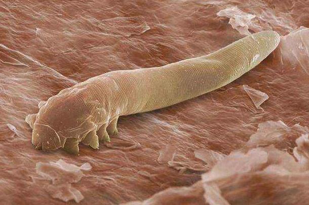 脸部螨虫多毛孔粗大,脸上螨虫毛孔粗大还能不能恢复