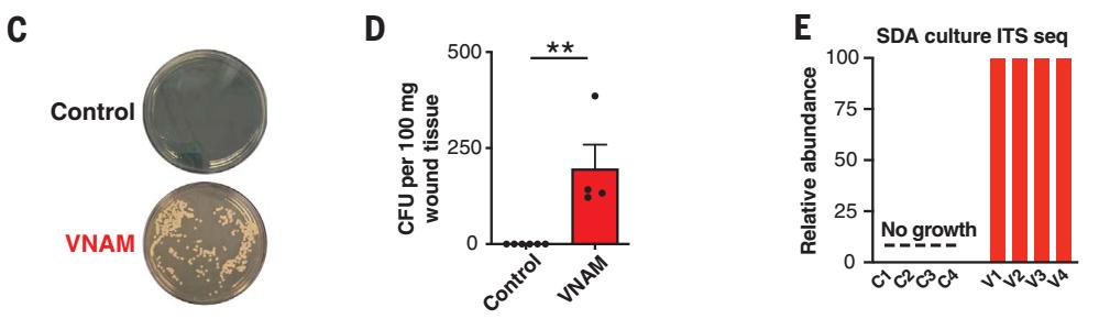奶酪可以改善肠道吗,奶酪里有酵母菌