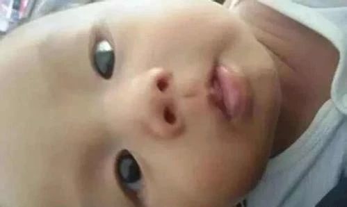 宝宝鼻梁发青是什么原因,婴儿鼻梁发青是什么征兆