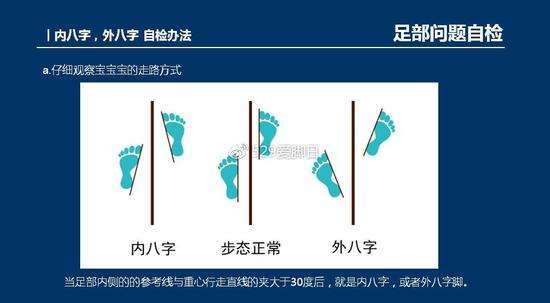 鞋子高帮和低帮影响孩子足踝发育吗？孩子八字脚怎样矫正？