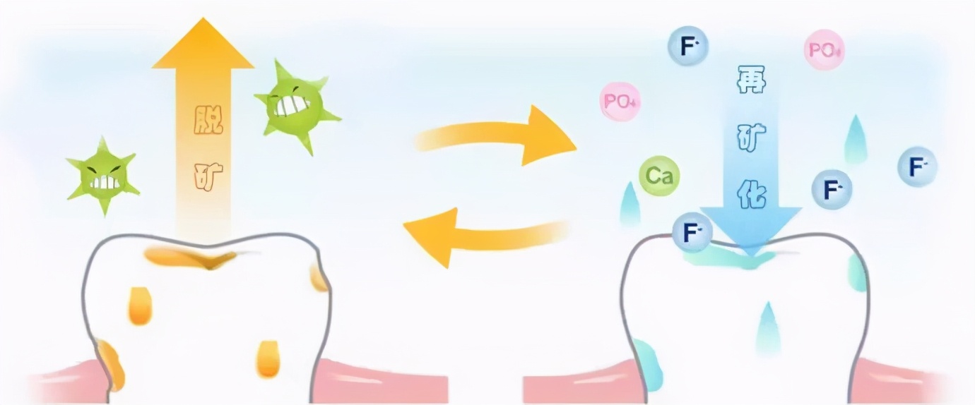 牙齿脱矿了如何补救,牙齿脱矿了怎么治