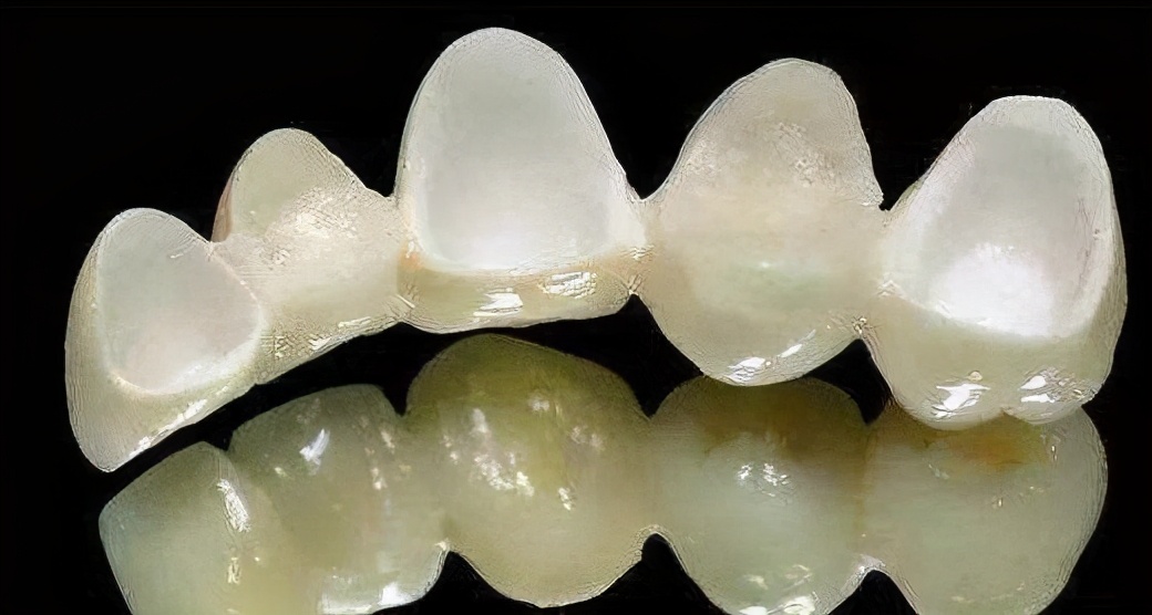 二氧化锆烤瓷牙分几个档次,二氧化锆烤瓷牙进口和国产区别