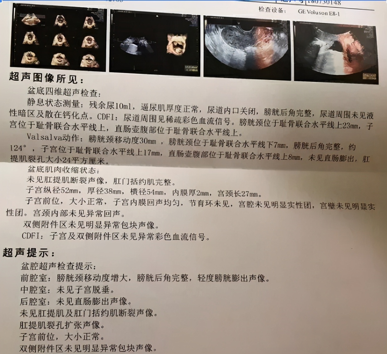 孕产康复|图解盆底肌肌力测试报告