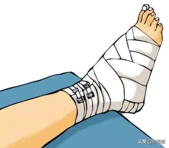 关于踝关节扭伤的正确处理方法,踝关节扭伤的早期处理原则是什么