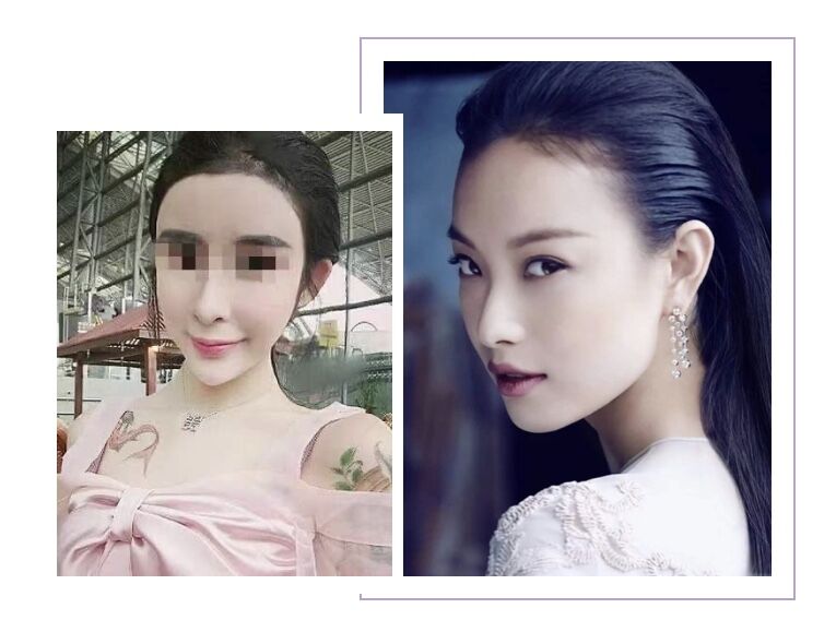 解密瘦脸针的几大常识性问题,关于瘦脸针的几个常识问题