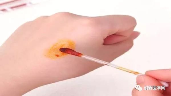 常用伤口消毒药,手术伤口消毒的正确方法