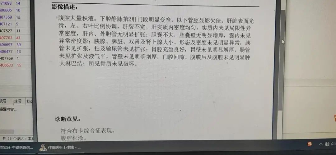 徐州医科大学附属医院布加综合征,布加综合征临床试验