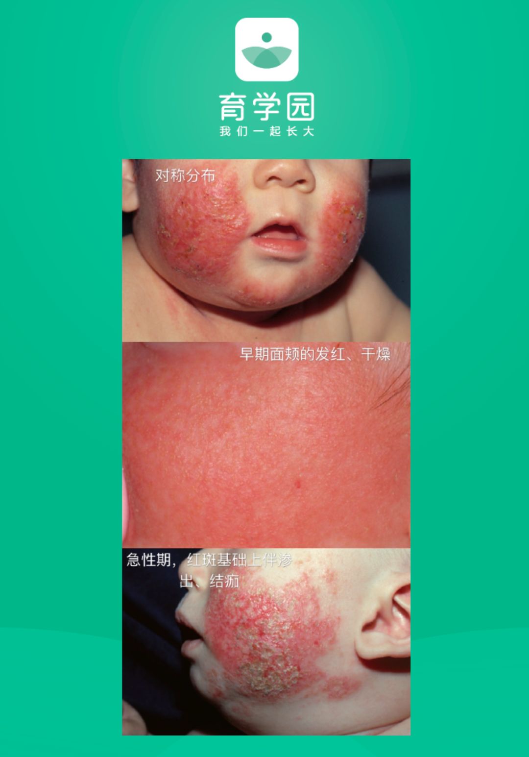 崔玉涛宝宝可以用的激素,崔玉涛谈小安素激素