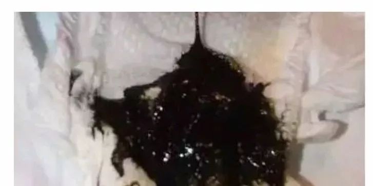 怎样判断新生儿宝宝大便是否正确,新生儿宝宝大便怎么判断是否正常