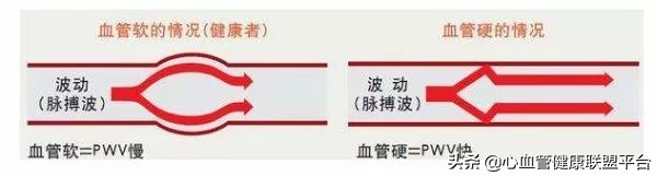 硬核科普｜血压检测不能少，动脉硬化你知多少？