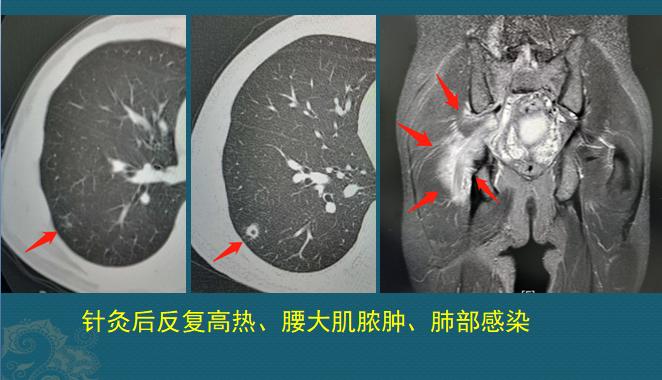 路边的野店不要去，花钱多，有些针还伤身体……