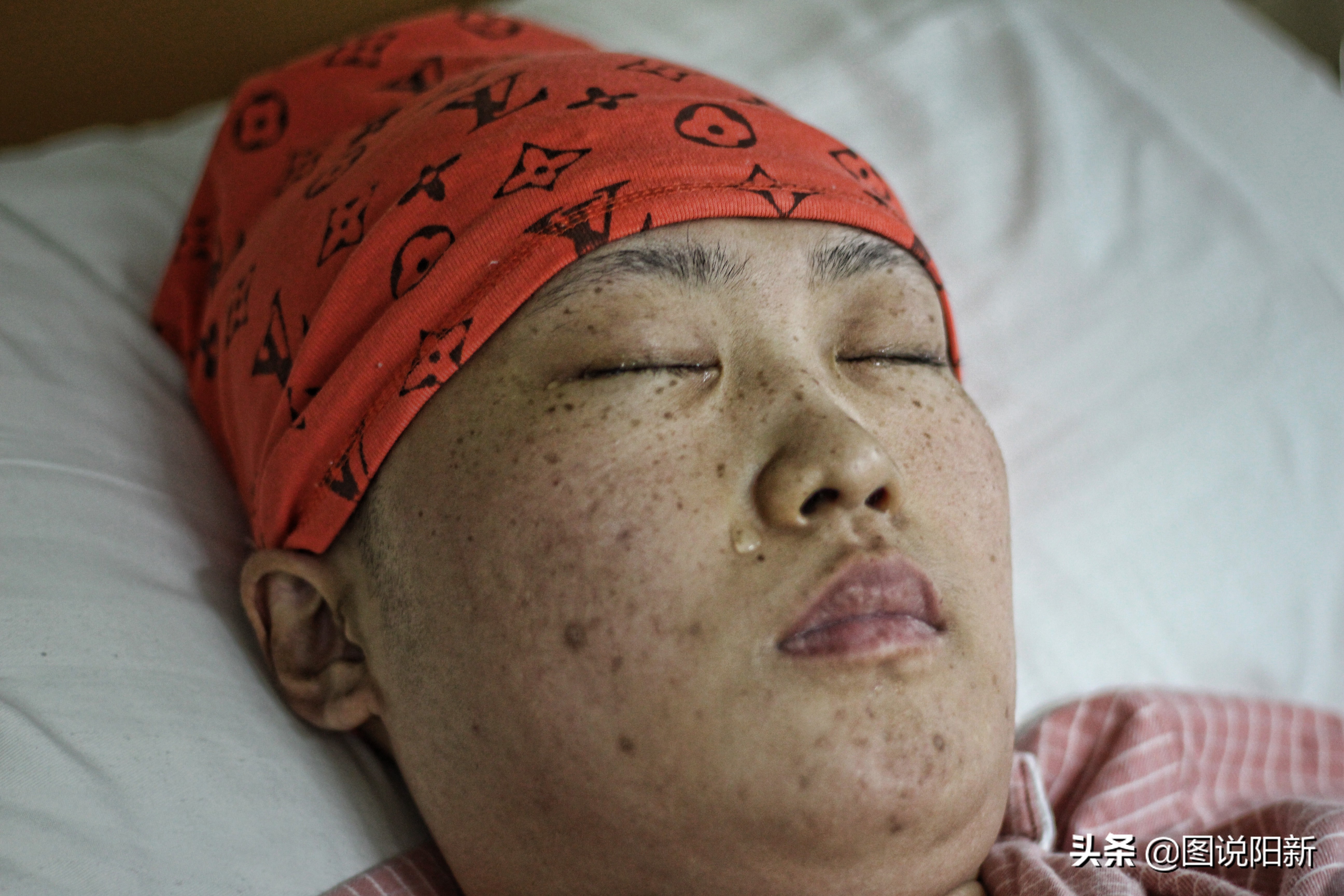 少女缺血15年放弃做母亲权利，疫情下遇“血荒”再陷困境