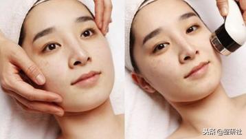 选择皮秒祛斑注意事项,选择光照美容仪的理由