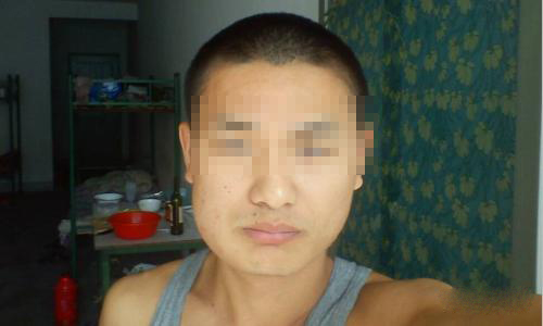 长期吃槟榔面部变化,长期吃槟榔的话会有坏处吗