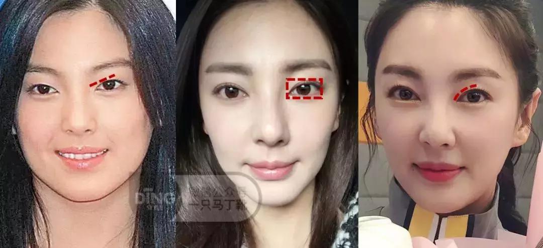 张雨绮杨丞琳对比,张雨绮眼型分析