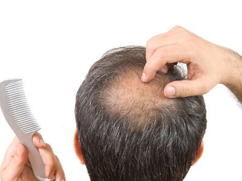 脱发没有毛孔了还能恢复吗,脱发后头发不长了怎么回事