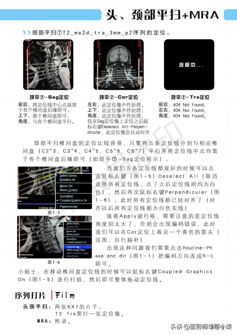 磁共振扫描技术西门子,西门子磁共振最新操作界面