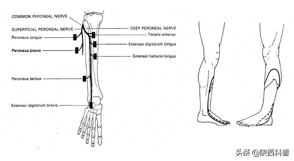 天天科普|跷二郎腿会影响“生育力”？快把腿放下来！