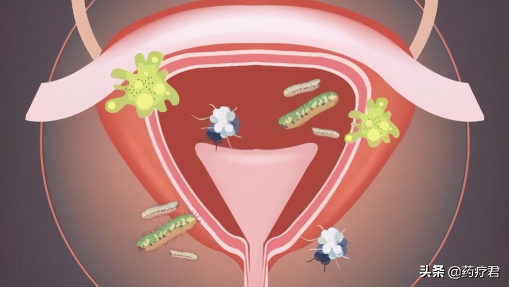 姨妈刚走避孕有用吗,姨妈刚走绝对安全吗