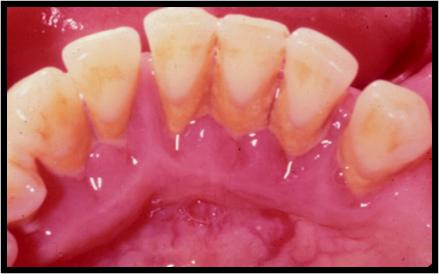 狗狗洗牙的良心忠告,医生忠告千万别洗牙