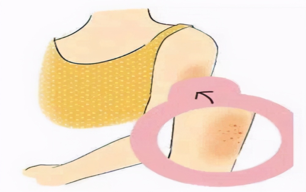 如何拥有好的皮肤教你这几招,怎样才能拥有白白净净的皮肤