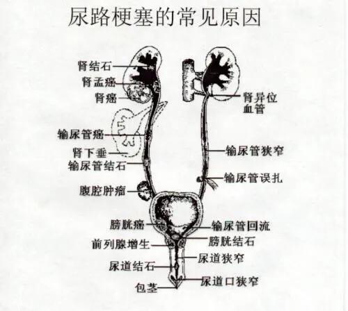 尿频尿急尿血反复发作女性,女性为什么会尿急尿频尿痛