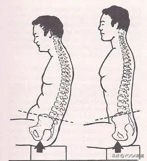 练瑜伽怎么改善一弯腰就拱背,瑜伽如何纠正骨盆旋转和侧移